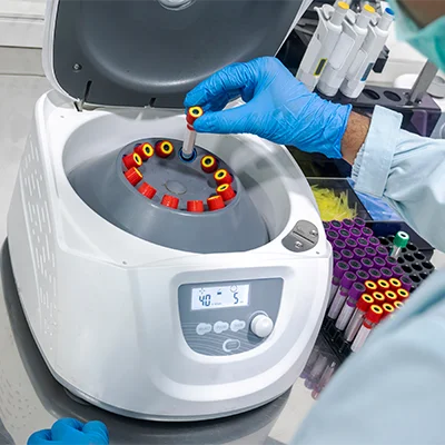 Laborfachkraft mit blauen Handschuhen setzt Blutprobe in eine Zentrifuge ein – medizinische Laboruntersuchung