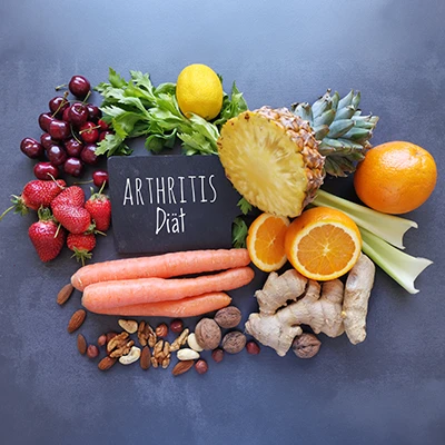 Lebensmittel rund um Tafel „ARTHRITIS Diät“ – Obst, Gemüse, Nüsse und Ingwer